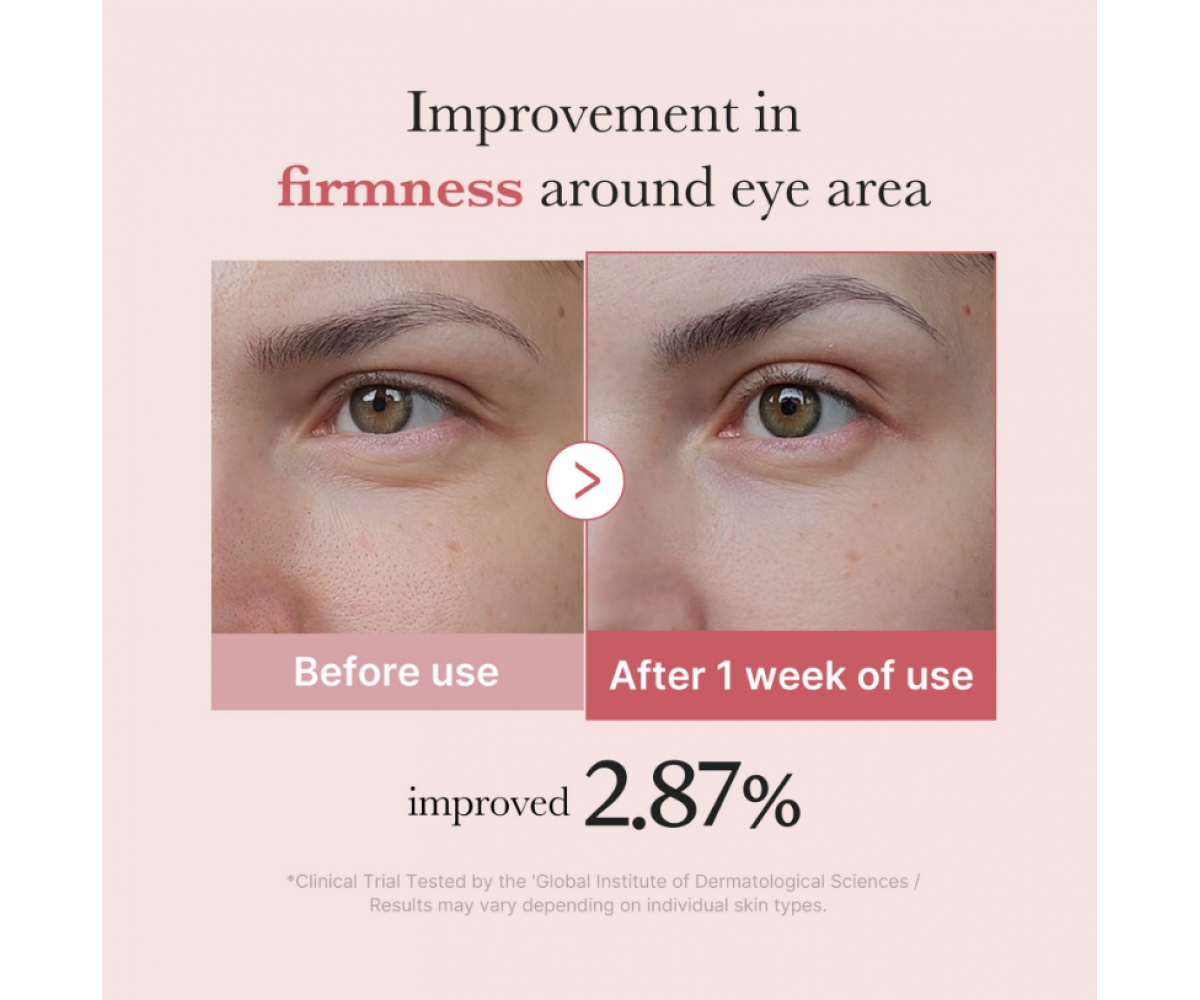 Medicube PDRN Pink Peptide Eye Cream 30ml κρέμα ματιών με PDRN και πεπτίδια