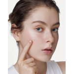 [name SOME BY MI Micro Pin Spot Patch - Επιθέματα για ακμή με μικροβελόνες (micro-needles)