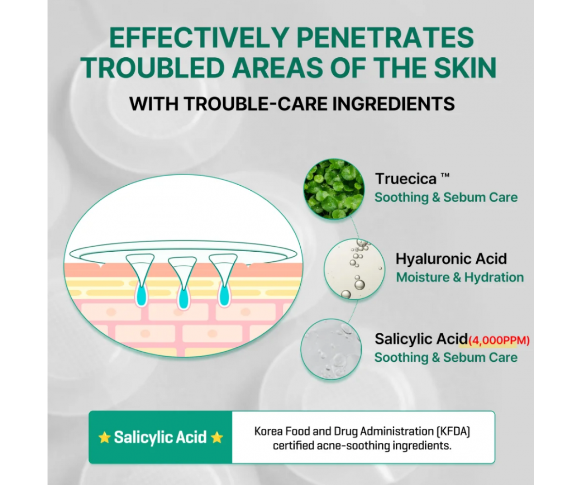 [name SOME BY MI Micro Pin Spot Patch - Επιθέματα για ακμή με μικροβελόνες (micro-needles)